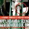 Usa, si rompe la gamba scendendo dallo scivolo col papà: la madre pubblica il video su Facebook